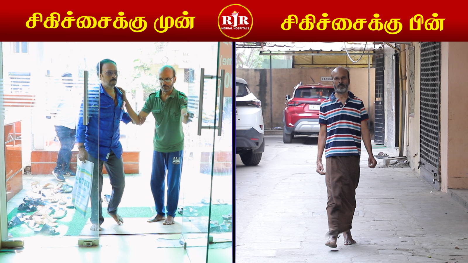 Before After